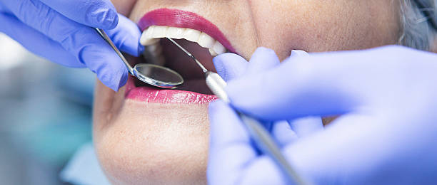 Best Emergency Broken Tooth Repair in St Vincent College, PA